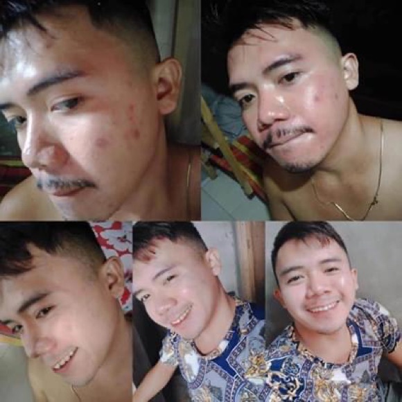 Beauty vault rejuvenating set - Picture 3 of 5